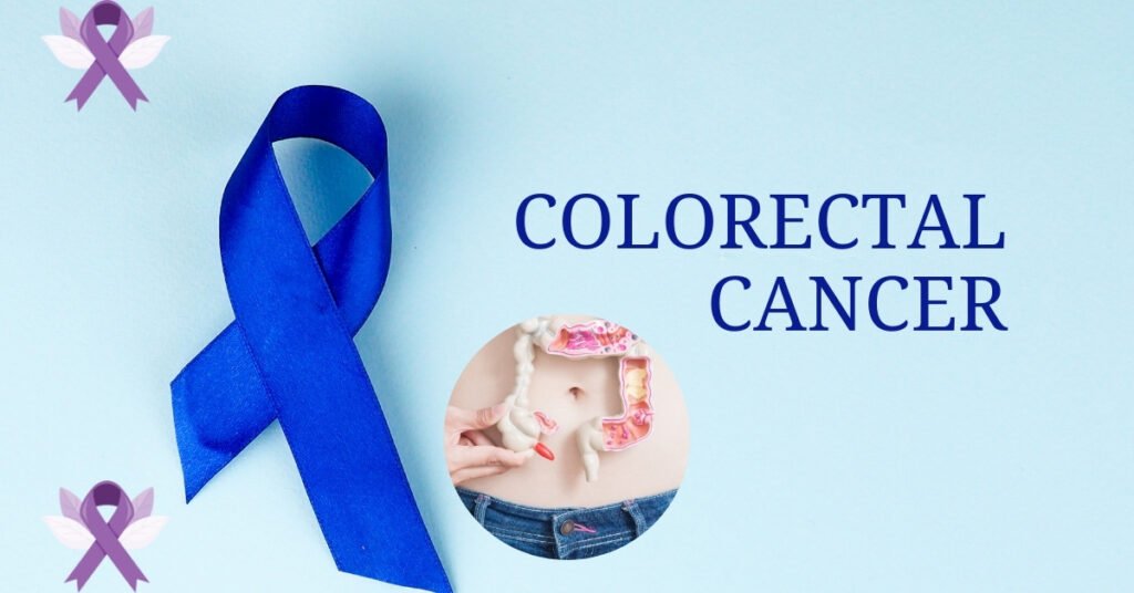 Colorectal cancer