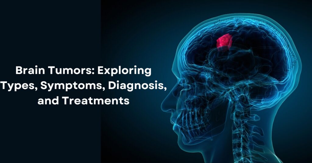 Brain Tumors