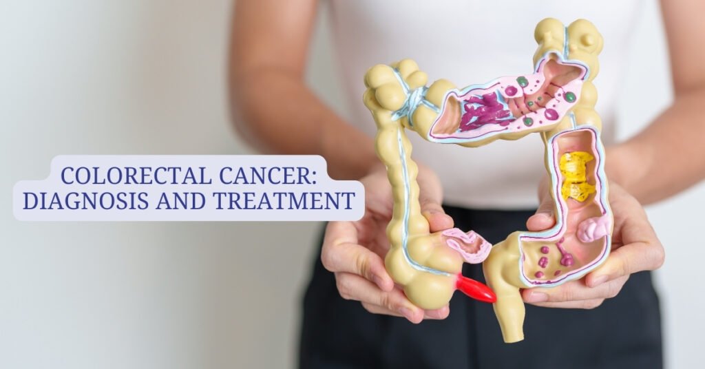 Colorectal Cancer: Diagnosis and Treatment