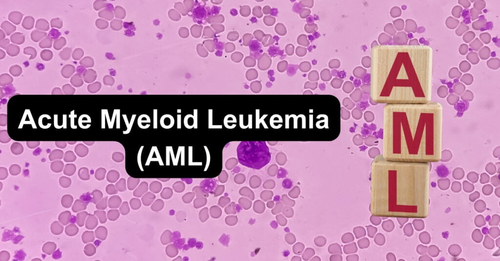 Acute Myeloid Leukemia (AML)