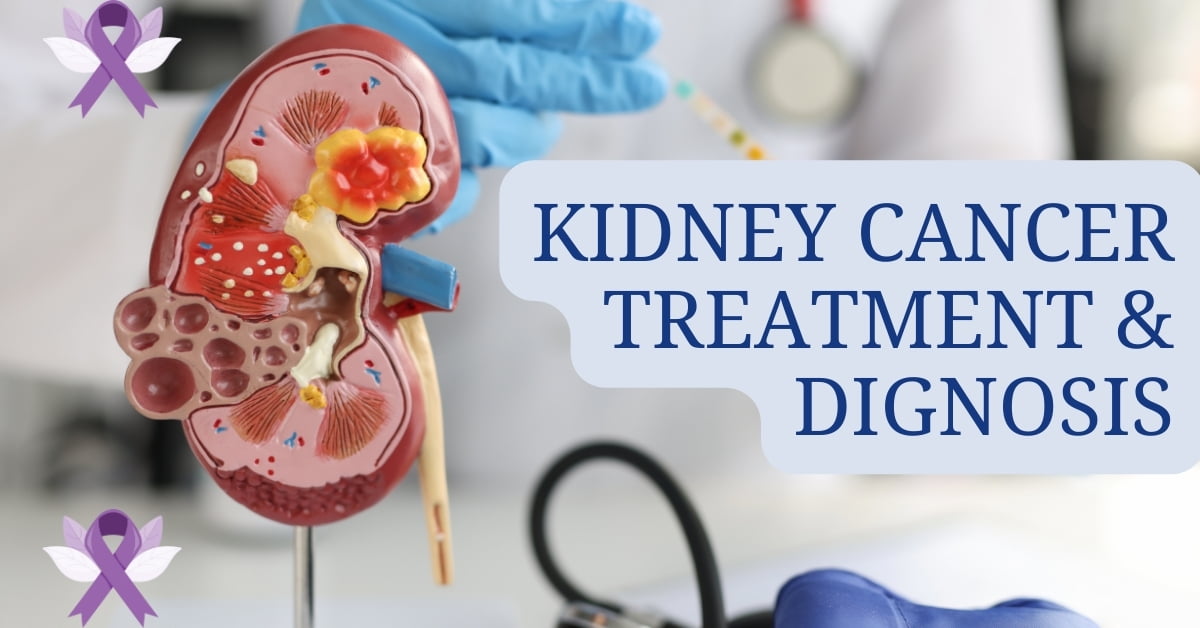 Kidney Cancer Treatment and Diagnosis