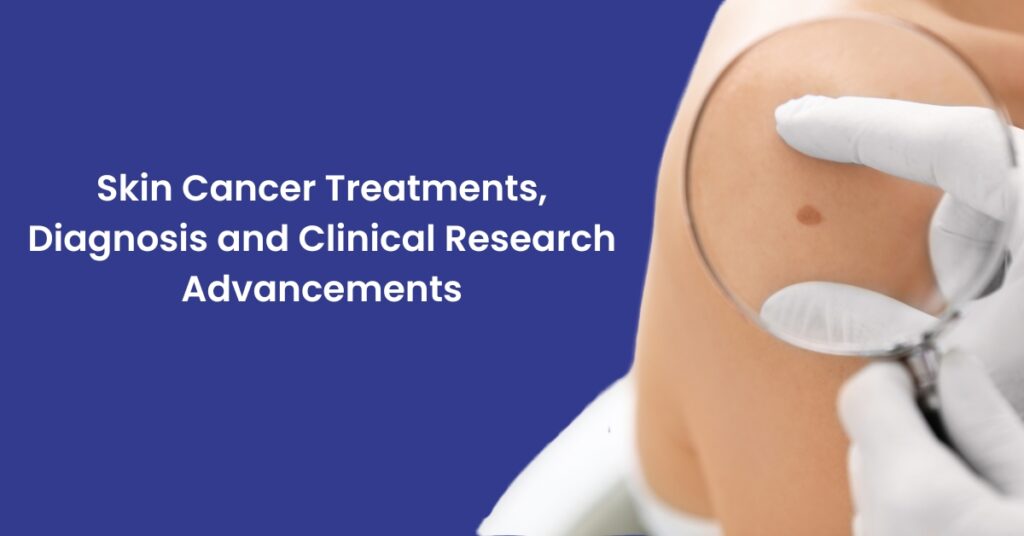 Skin Cancer Treatments, Diagnosis and Clinical Research Advancements