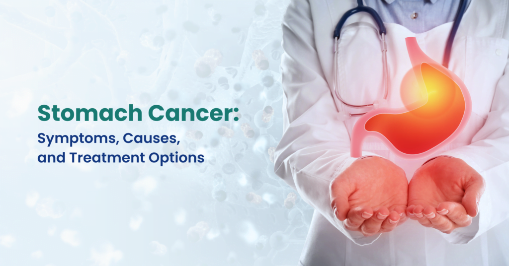 Bladder Cancer