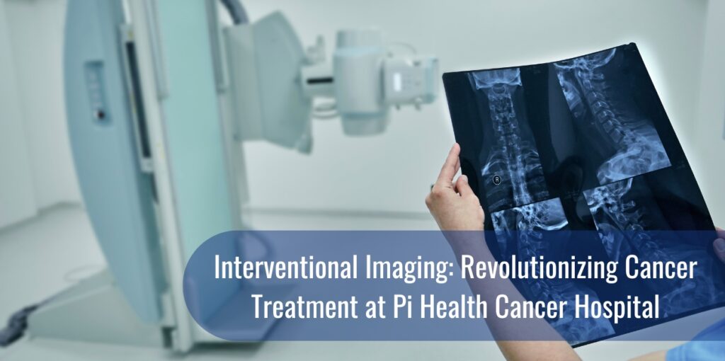 Interventional Imaging: Revolutionizing Cancer Treatment at Pi Health Cancer Hospital