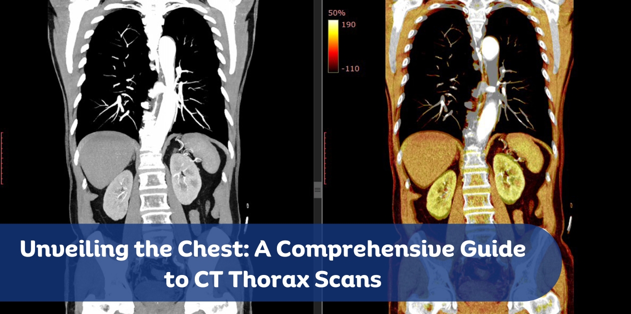 Unveiling the Chest: A Comprehensive Guide to CT Thorax Scans