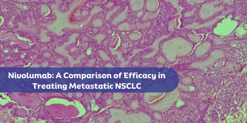 Nivolumab: A Comparison of Efficacy in Treating Metastatic NSCLC