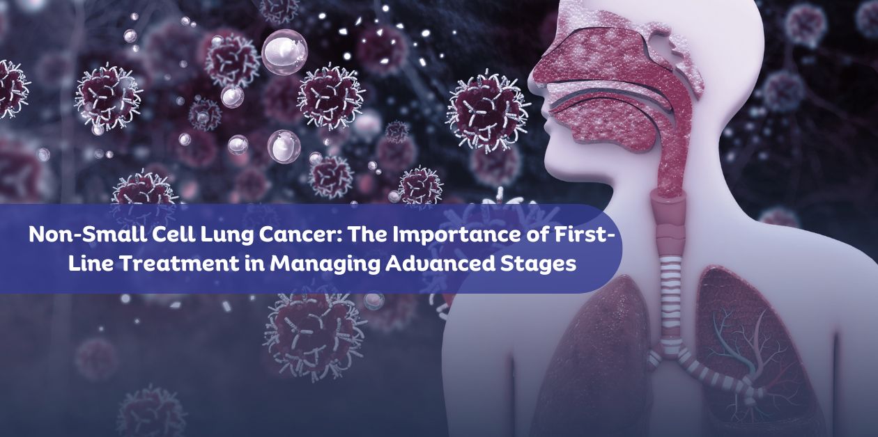 Lung cancer remains one of the most prevalent and deadly cancers worldwide, with Non-small cell lung cancer (NSCLC) accounting for the majority of lung cancer cases