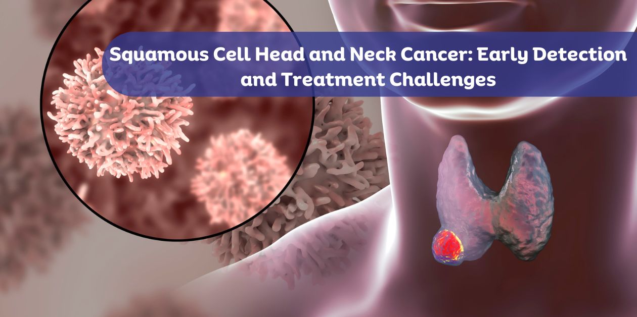 Squamous cell carcinoma