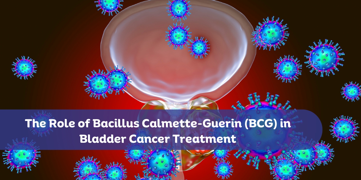 The Role of Bacillus Calmette-Guerin (BCG) in Bladder Cancer Treatment: