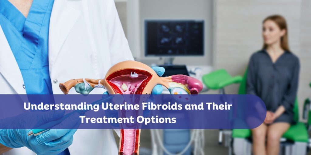 Uterine Fibroids