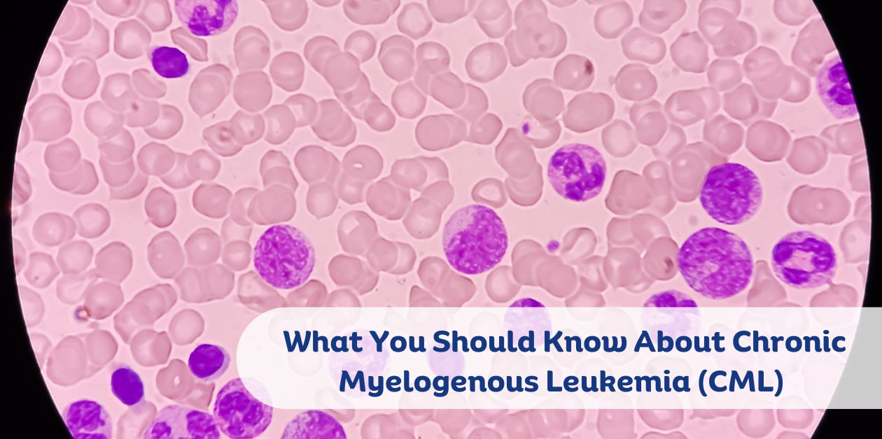 Chronic Myelogenous Leukemia